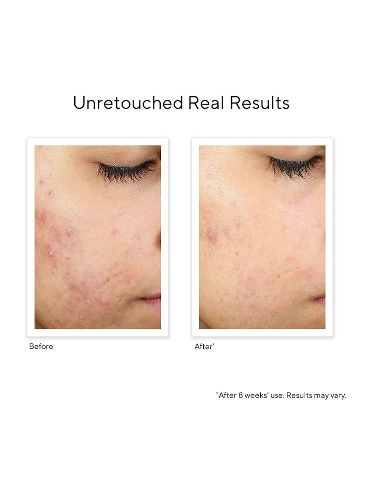 Murad InvisiScar Recovery Treatment 15ml - Image 2 of 5