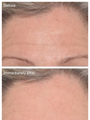 Murad Targeted Wrinkle Corrector Mask 15ml - Image 2 of 6