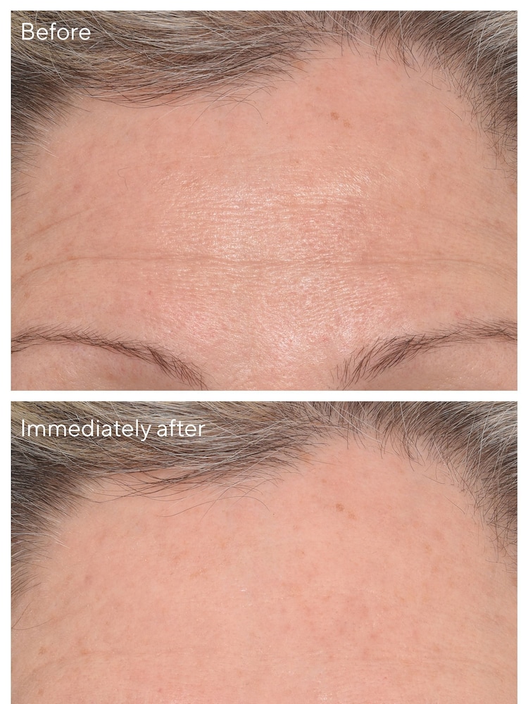Murad Targeted Wrinkle Corrector Mask 15ml - Image 2 of 6