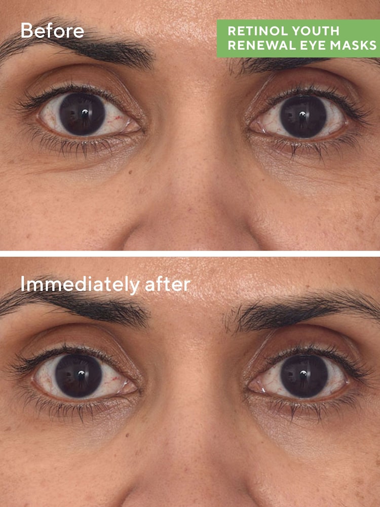 Murad Retinol Youth Renewal Eye Mask - Image 2 of 5 Murad Retinol Youth Renewal Eye Mask - Image 2 of 5