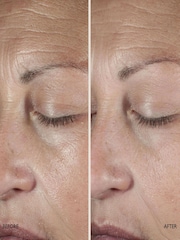 Omorovicza Queen Serum 30ml - Image 3 of 5