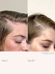 Living Proof Scalp Care Density Serum 50ml - Image 5 of 8
