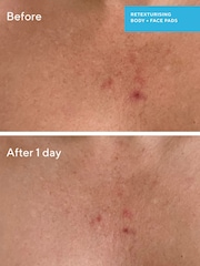 Retexturizing Body + Face Pads - Image 3 of 7
