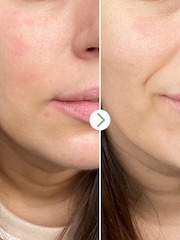PAI Partners in Calm Cleanser Moisturizer Set (Worth £38) - Image 5 of 5