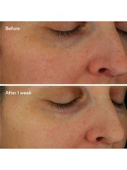 Murad Restorative HydroHyaluronic Cream - Image 3 of 4