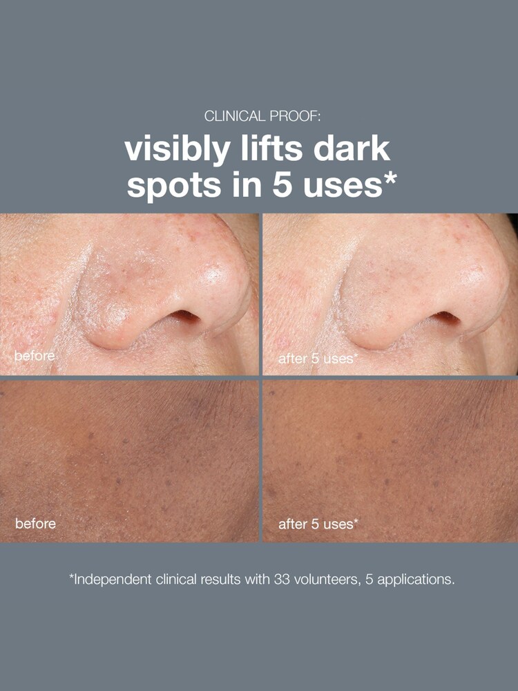 Dermalogica PowerBright Dark Spot Peel 50ml - Image 2 of 5