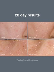 Dermalogica PowerBright Dark Spot System Kit (Worth £178) - Image 5 of 5
