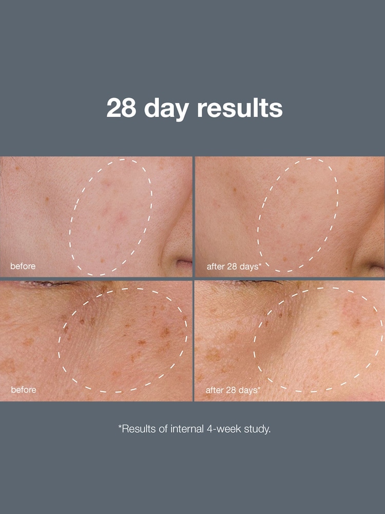 Dermalogica PowerBright Dark Spot System Kit (Worth £178) - Image 5 of 5