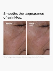 The Ordinary The Age Support Set - Image 2 of 7