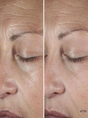 Omorovicza Queen Serum - Image 3 of 5