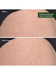 Murad Retinal ReSculpt Body Treatment 148ml - Image 4 of 4