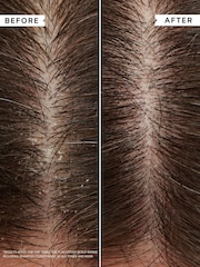 Philip Kingsley Flaky/Itchy Scalp AntiDandruff Shampoo for Curly Hair 75ml - Image 4 of 8