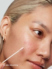 Kate Somerville EradiKate Acne Treatment  30 ml / 1 fl oz Blemish Treatment as seen in UK market - Image 7 of 9