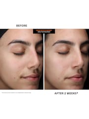 Kate Somerville ExfoliKate Cleanser Daily Foaming Wash  120 ml - Image 5 of 10