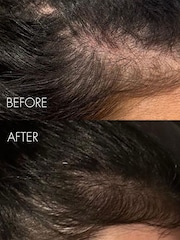 Sweed The Hair Serum 6ml - Image 4 of 5