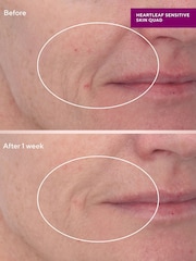 Murad Heartleaf Gentle Resurfacing Serum 30ml - Image 5 of 5