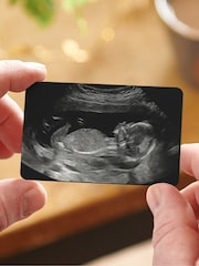 Baby Scan Photo Insert Card Wallet by No Ordinary Gift - Image 1 of 2