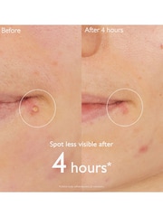 Caudalie Vinopure Salicylic Spot Solution Serum 15ml - Image 3 of 5