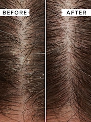 Philip Kingsley Flaky Itch Scalp Shampoos Trio - Image 3 of 5
