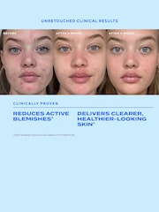 Murad Biome Balancing Clear Prevent Blemish Treatment Serum - Image 5 of 10
