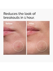 The Ordinary Sulfur 10% Powder-to-Cream Concentrate 5g - Image 3 of 8