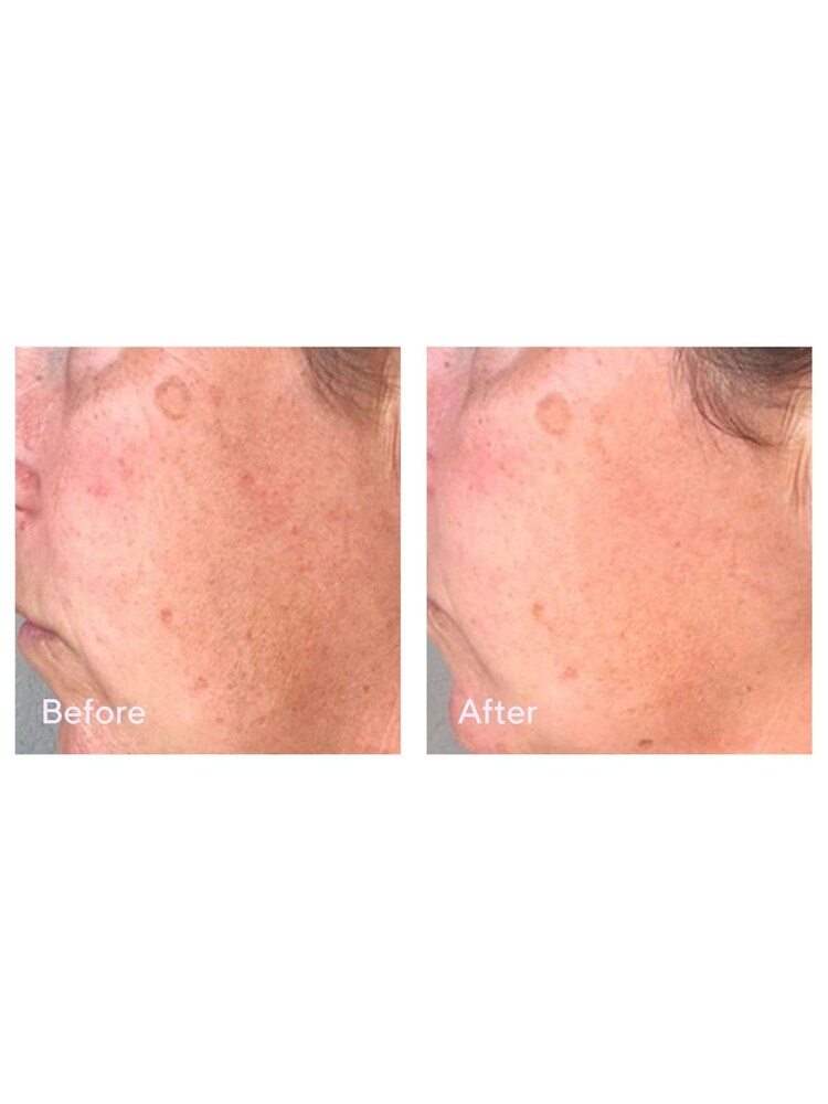 Murad Correct & Protect Broad Spectrum SPF45 30ml - Image 5 of 5