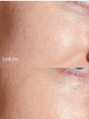 Dermalogica Porescreen SPF 40 Sun Cream 30ml - Image 5 of 6