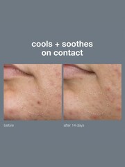 Dermalogica Deep Breakout Liquid Patch 15ml - Image 3 of 5