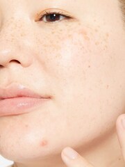 Dermalogica Deep Breakout Liquid Patch 15ml - Image 4 of 5