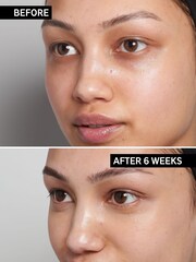 The INKEY List 15% Vitamin C And EGF Serum 30ml - Image 3 of 4