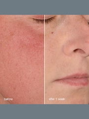 Dermalogica Stabilizing Repair Cream 50ml - Image 3 of 5