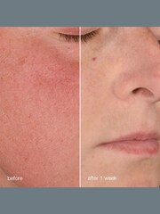 Dermalogica Stabilizing Repair Cream 50ml - Image 4 of 5