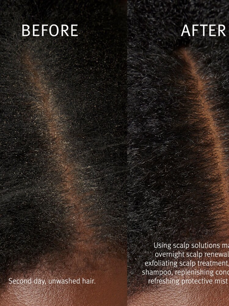 Aveda Scalp Solutions Exfoliating Scalp Treatment 150ml - Image 5 of 5