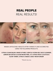 NUDESTIX Nudeskin Lemonaid Detox  Glow Micropeel 60ml - Image 3 of 5