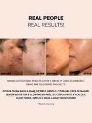 NUDESTIX Nudeskin Lemonaid Detox  Glow Micropeel 60ml - Image 4 of 5
