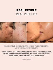 NUDESTIX Nudeskin Citrus C Mask  Daily Moisturiser 60ml - Image 4 of 5