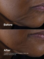 Clinique Smart Clinical Repair Lifting Face & Neck Cream 50ml - Image 3 of 5