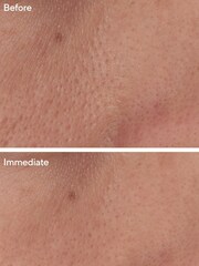 Murad Targeted Pore Corrector 15ml - Image 5 of 5