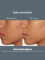 Dermalogica Daily Microfoliant Travel Size 13g - Image 2 of 5
