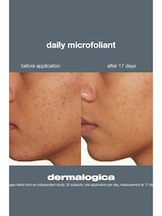 Dermalogica Daily Microfoliant Travel Size 13g - Image 5 of 5