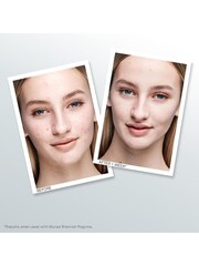 Murad Outsmart Blemish Clarifying Treatment 50ml - Image 2 of 3