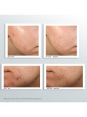 Murad Outsmart Blemish Clarifying Treatment 50ml - Image 3 of 3