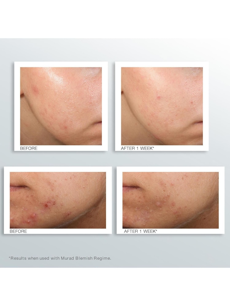 Murad Outsmart Blemish Clarifying Treatment 50ml - Image 3 of 3