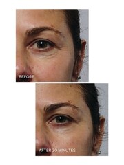 Murad Rapid Collagen Infusion 30ml - Image 2 of 2