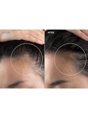 FOREO Blue FAQ 301 Hair Treatments & Masks - Image 2 of 5