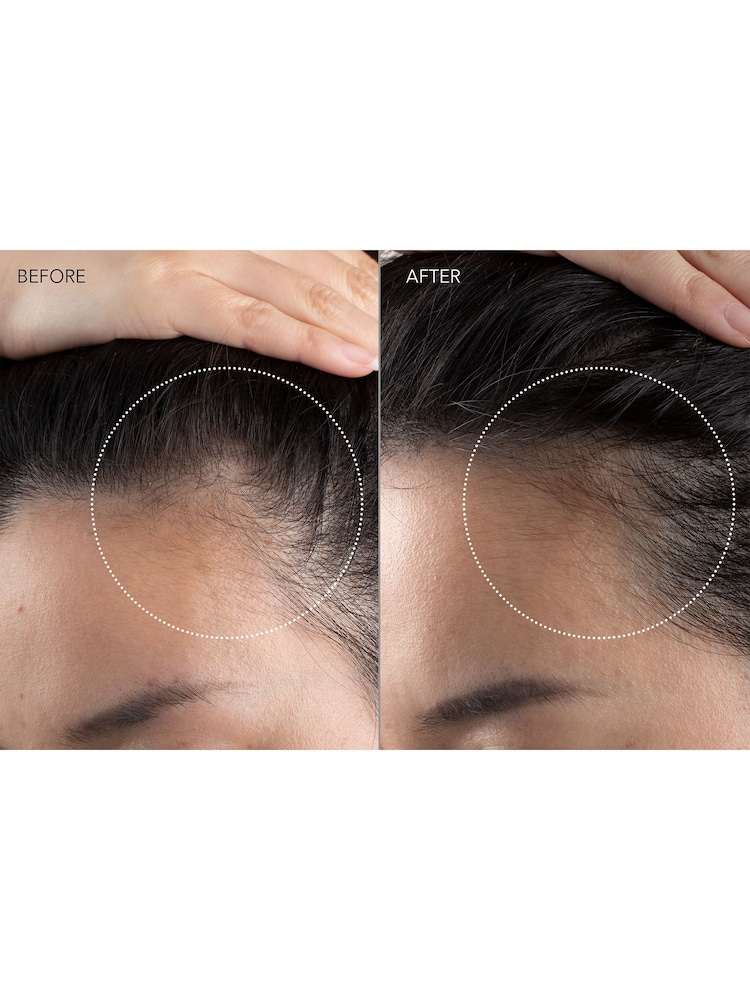 FOREO FAQ Scalp Recovery Thick Hair Probiotic Serum 60 ML - Image 2 of 5
