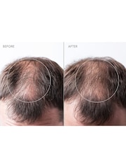 FOREO FAQ Scalp Recovery Thick Hair Probiotic Serum 60 ML - Image 3 of 5