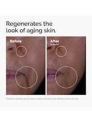 The Ordinary The Renewal Limited Edition Skincare Gift Set (Worth £33) - Image 4 of 8