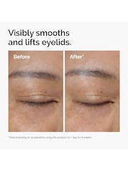 The Ordinary Lacto-PDRN* 4% + B9 Eye Cream - 15ml - Image 3 of 7