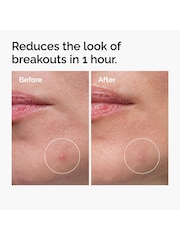 The Ordinary The Target Treat Limited Edition Skincare Gift Set (Worth £11.50) - Image 4 of 8